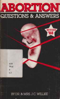 1911649 - Abortion, Questions & Answers